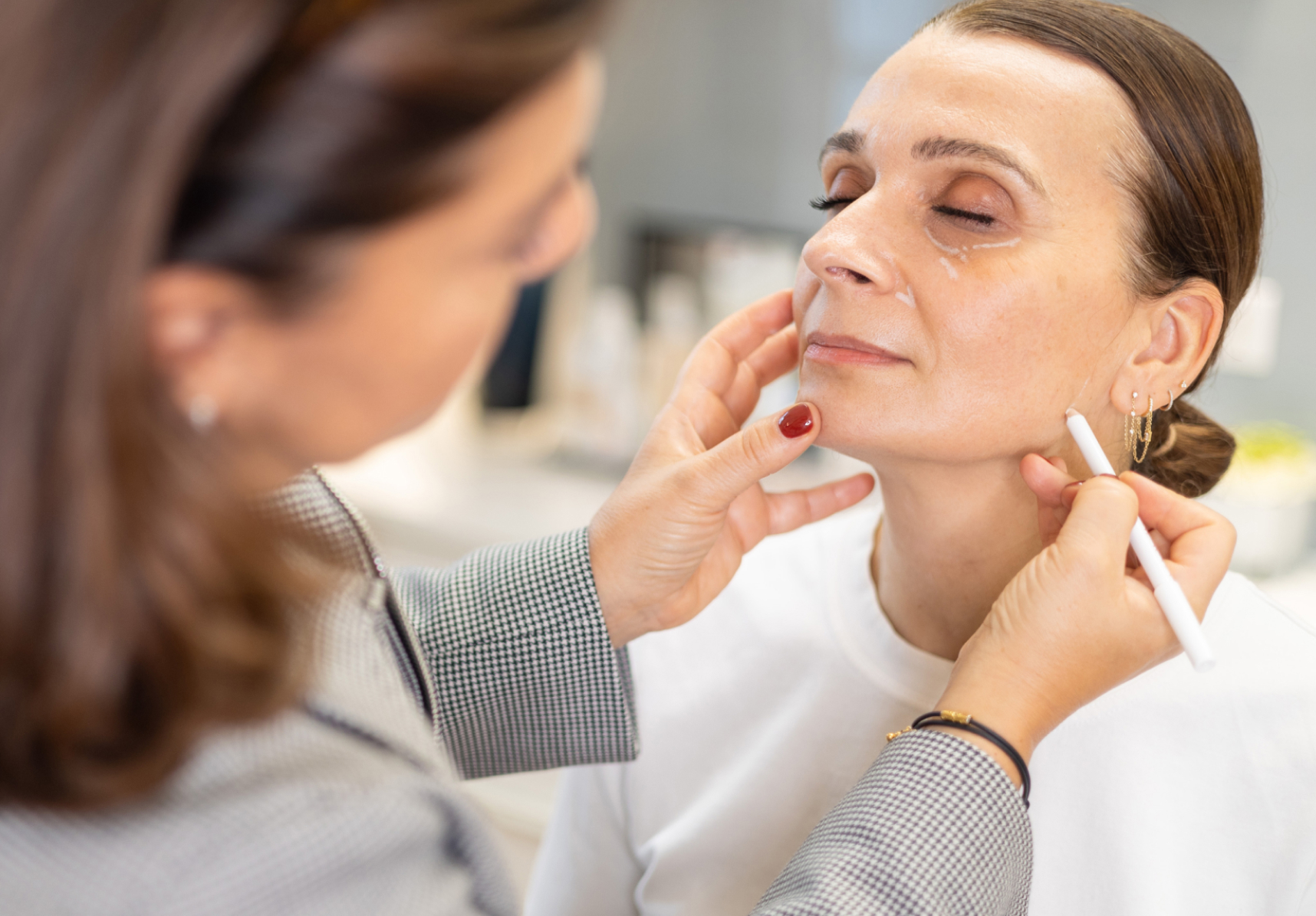 Traitement des cernes : injection acide hyaluronique | Paris | Dr Kathleen Scemama