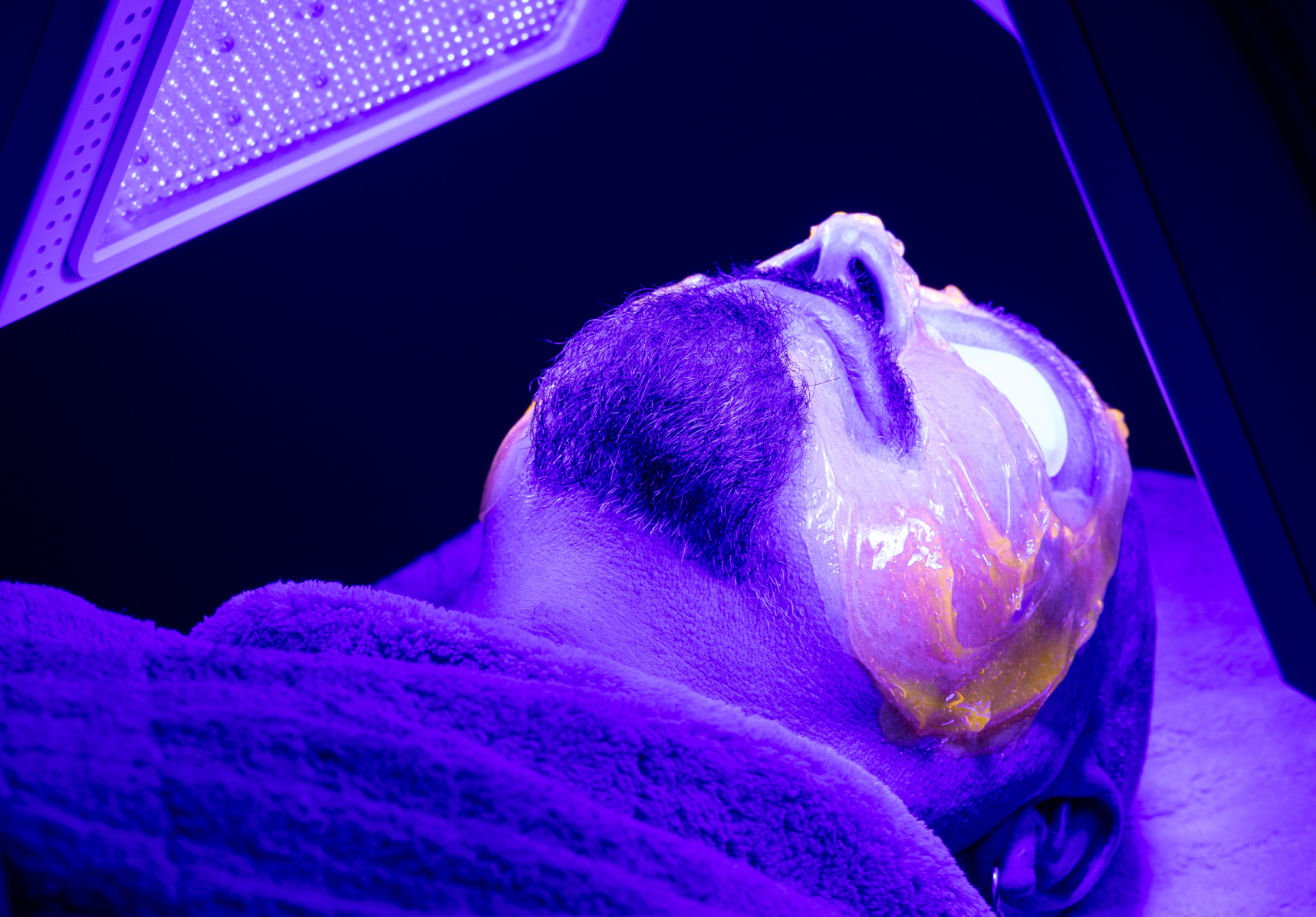 Kleresca : améliorer la qualité votre peau | Dr Kathleen Scemama | Paris
